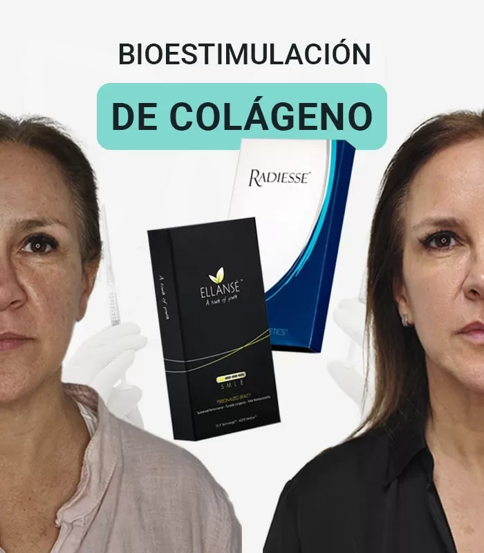 Bioestimulador de Colágeno