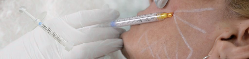 Bioestimulación de Colágeno